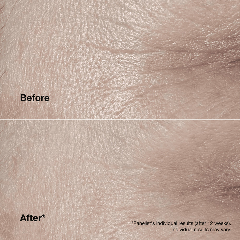Clinique Smart Clinical Repair™ Wrinkle Correcting Cream