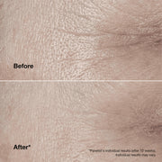 Clinique Smart Clinical Repair™ Wrinkle Correcting Cream