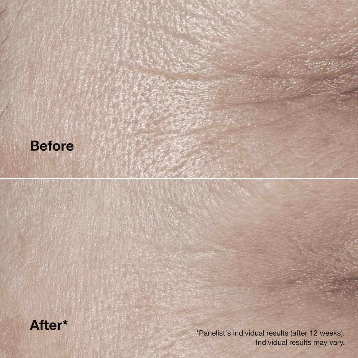 Clinique Smart Clinical Repair™ Wrinkle Correcting Cream