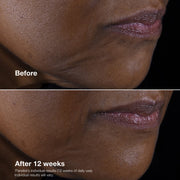 Clinique Smart Clinical Repair™ Lifting Face + Neck Cream