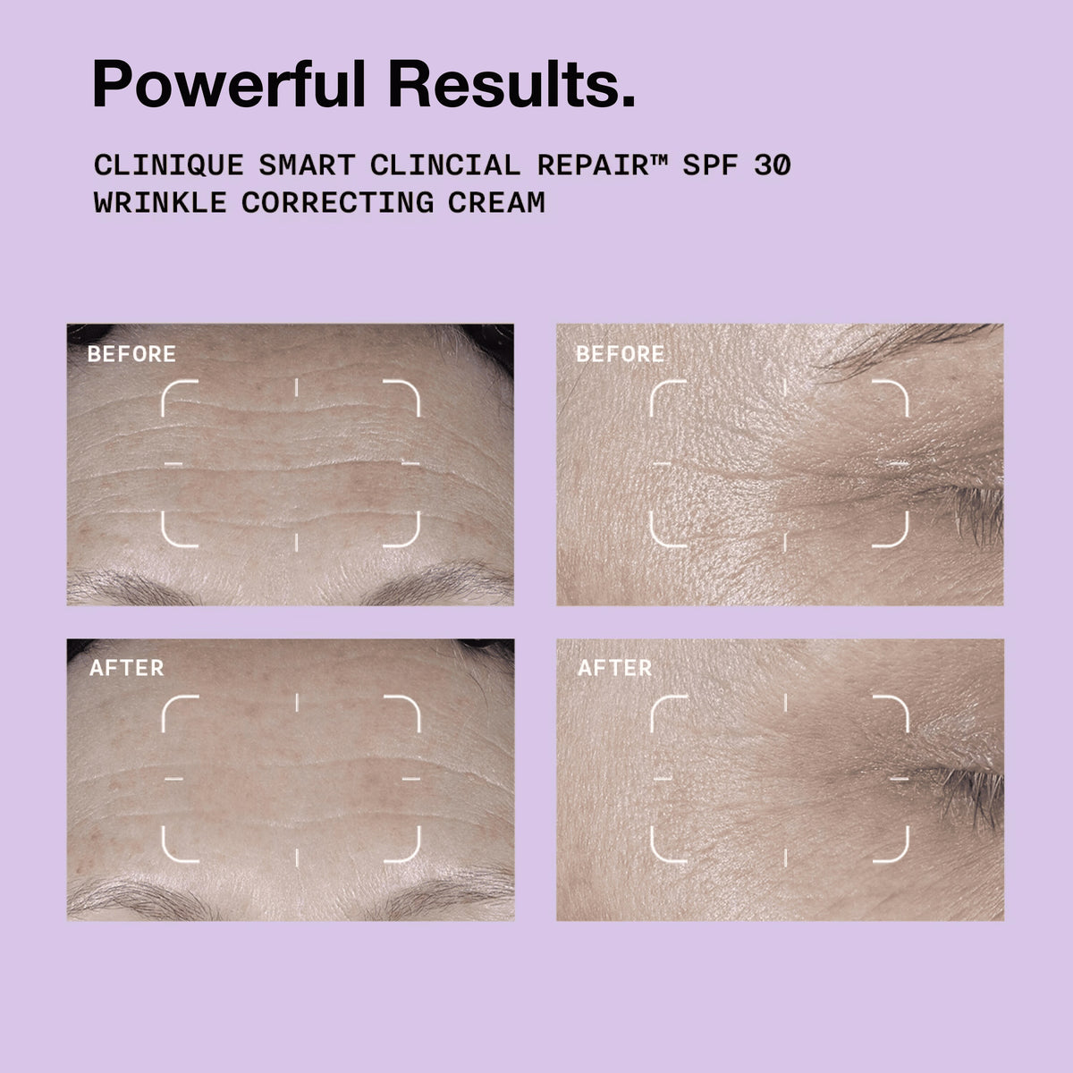 Clinique Smart Clinical Repair™ SPF 30 Wrinkle Correcting Cream