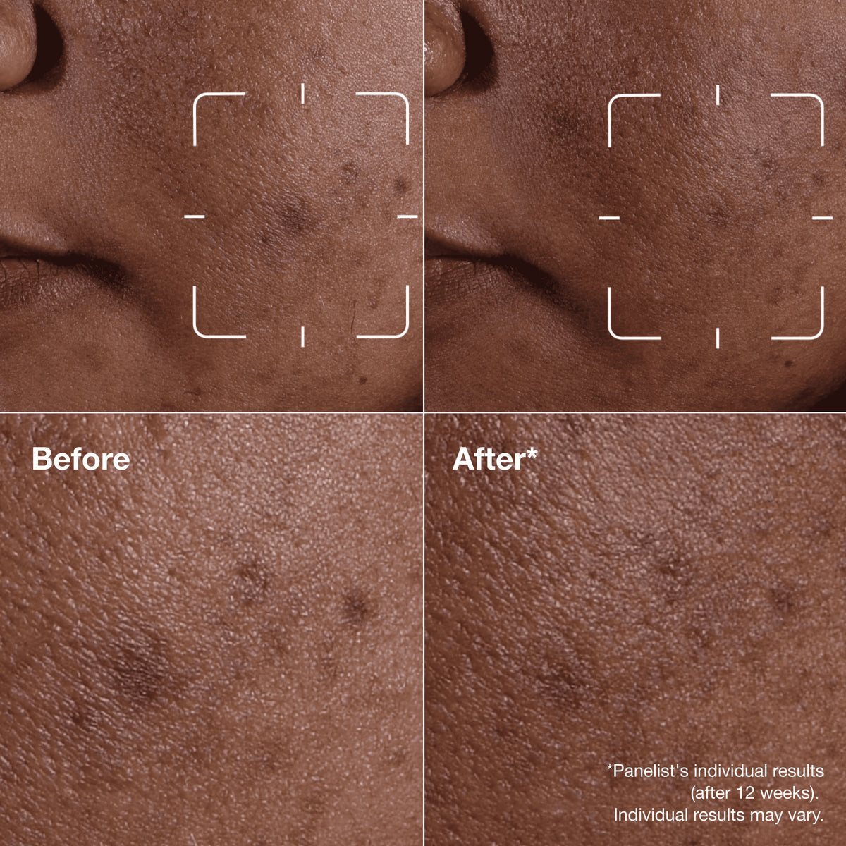 Even Better Clinical™ Dark Spot Clearing Serum