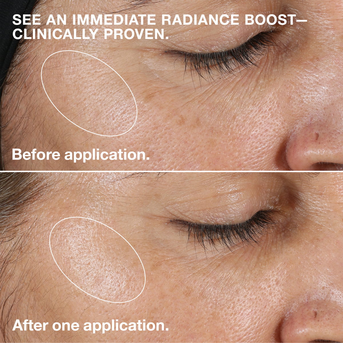Clarifying Lotion 2 – for Dry Combination Skin