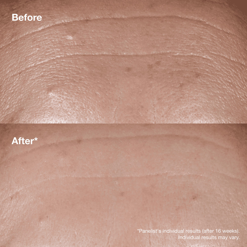 Clinique Smart Clinical Repair™ Wrinkle Correcting Serum