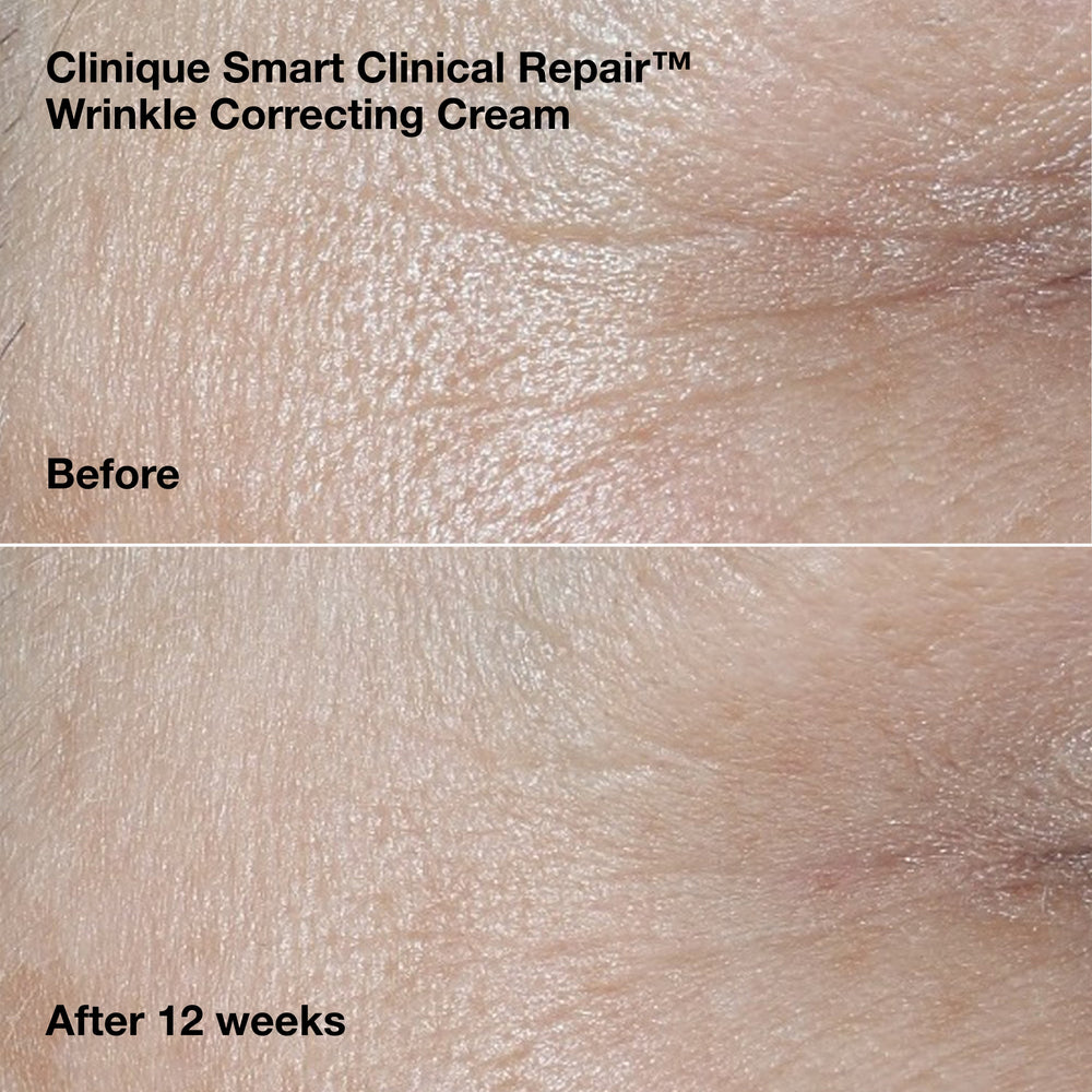 Smart Clinical Repair™ Wrinkle Correcting Cream Gift Set, Model, medium