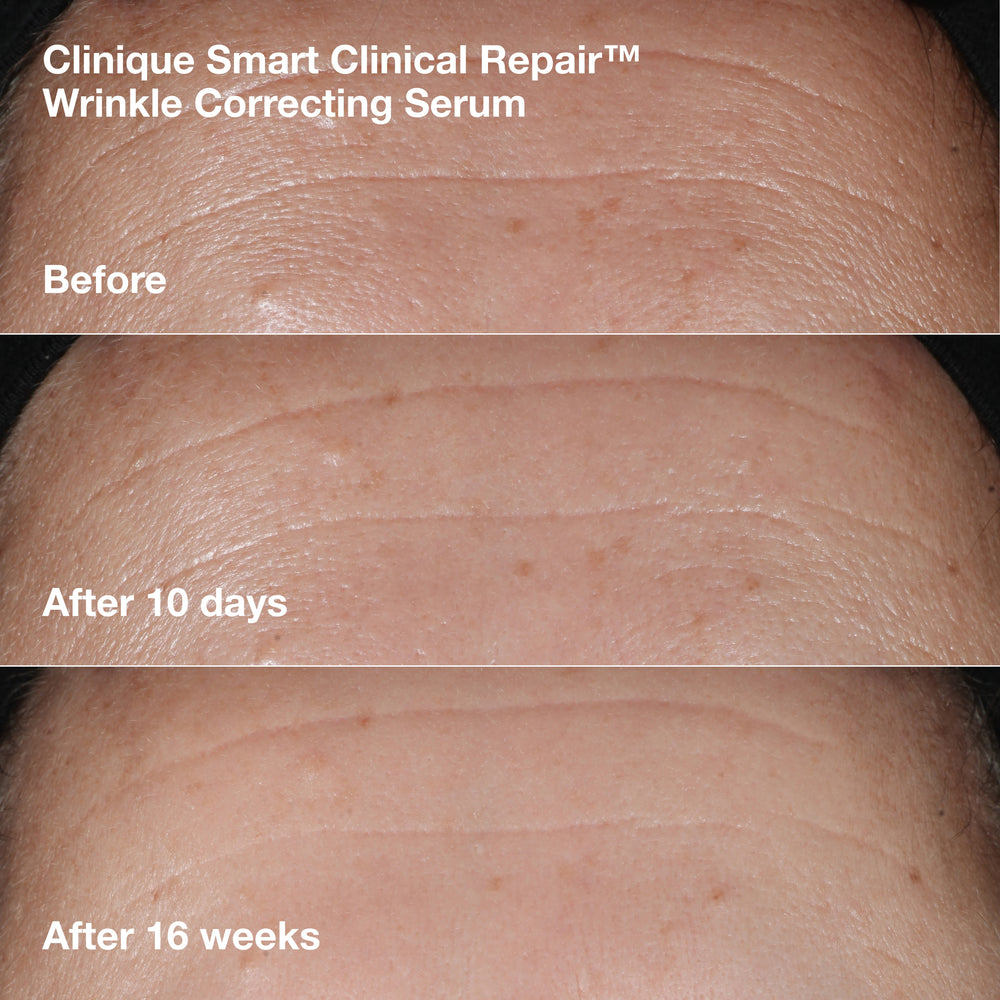Smart Clinical Repair™ Wrinkle Correcting Cream Gift Set, Model, medium