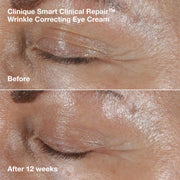 Smart Clinical Repair™ Wrinkle Correcting Serum Gift Set, Model, medium