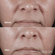 Clinique Smart Clinical Repair™ Wrinkle Correcting Rich Cream
