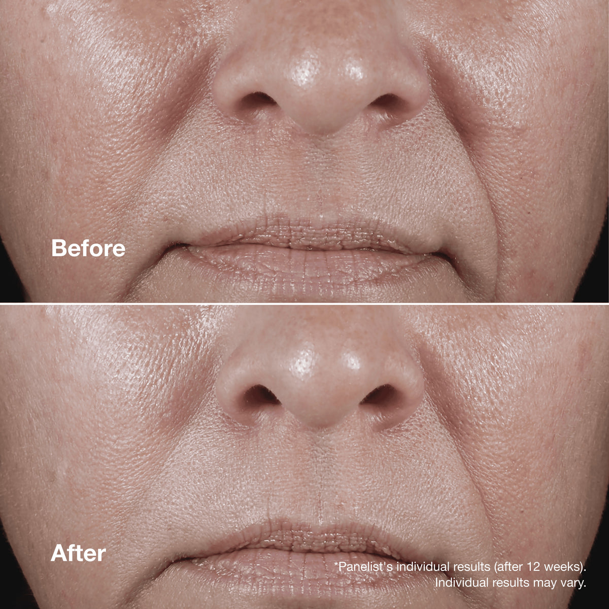 Clinique Smart Clinical Repair™ Wrinkle Correcting Rich Cream