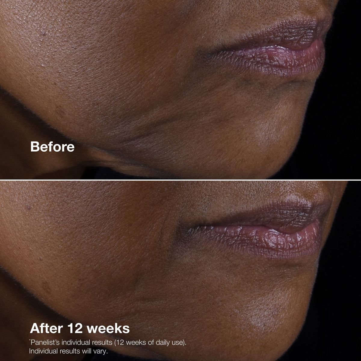 Clinique Smart Clinical Repair™ Lifting Face + Neck Cream