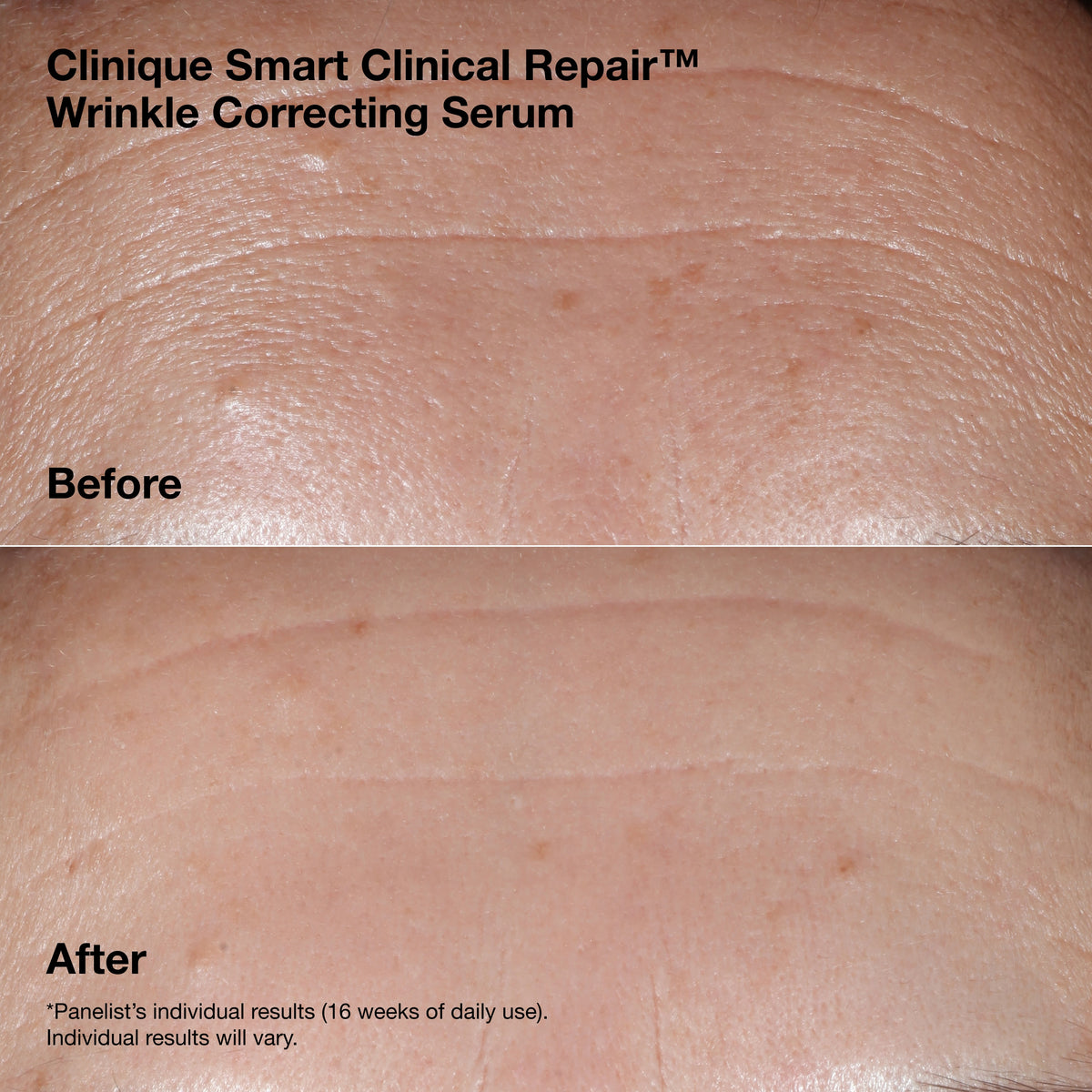 Smart Clinical Repair™ Wrinkle Correcting Serum Gift Set