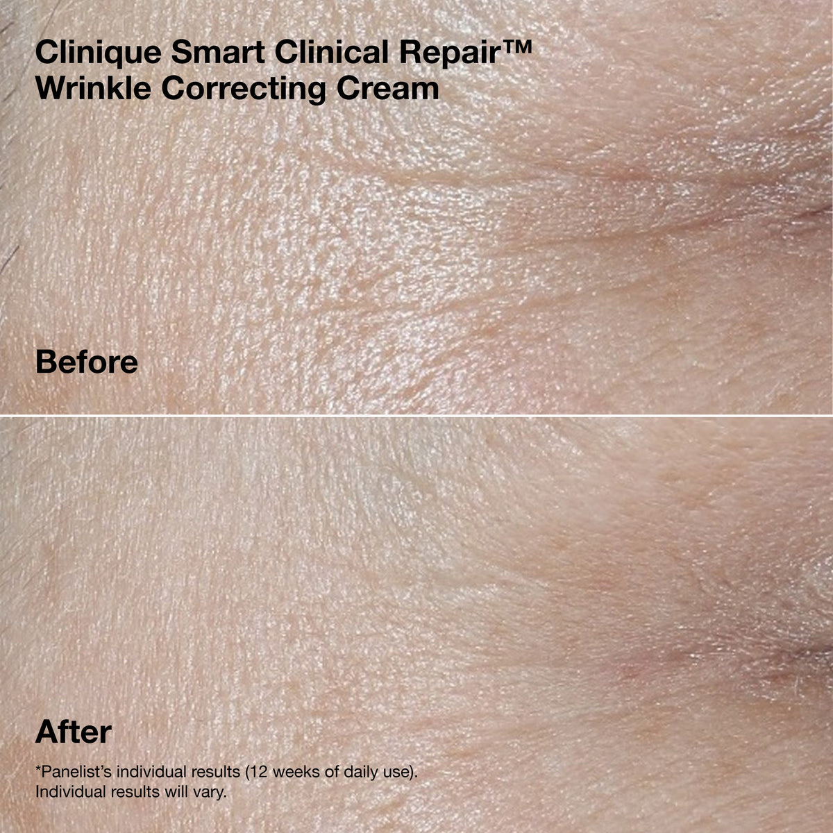 Smart Clinical Repair™ Wrinkle Correcting Serum Gift Set