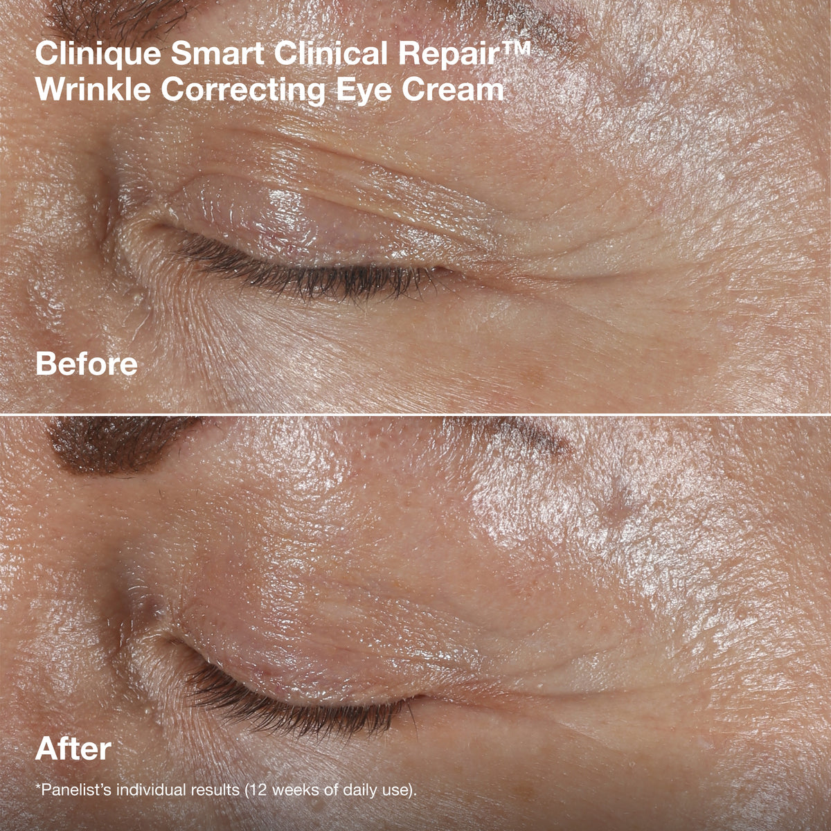 Smart Clinical Repair™ Wrinkle Correcting Serum Gift Set
