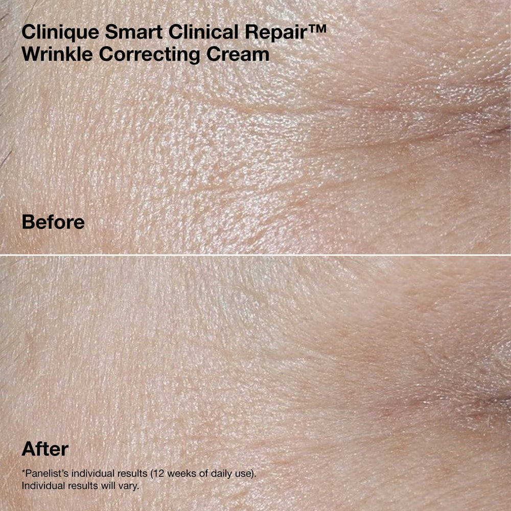 Smart Clinical Repair™ Wrinkle Correcting Cream Gift Set
