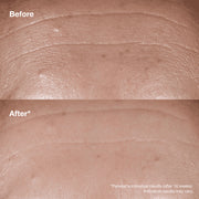 Clinique Smart Clinical Repair™ Wrinkle Correcting Serum