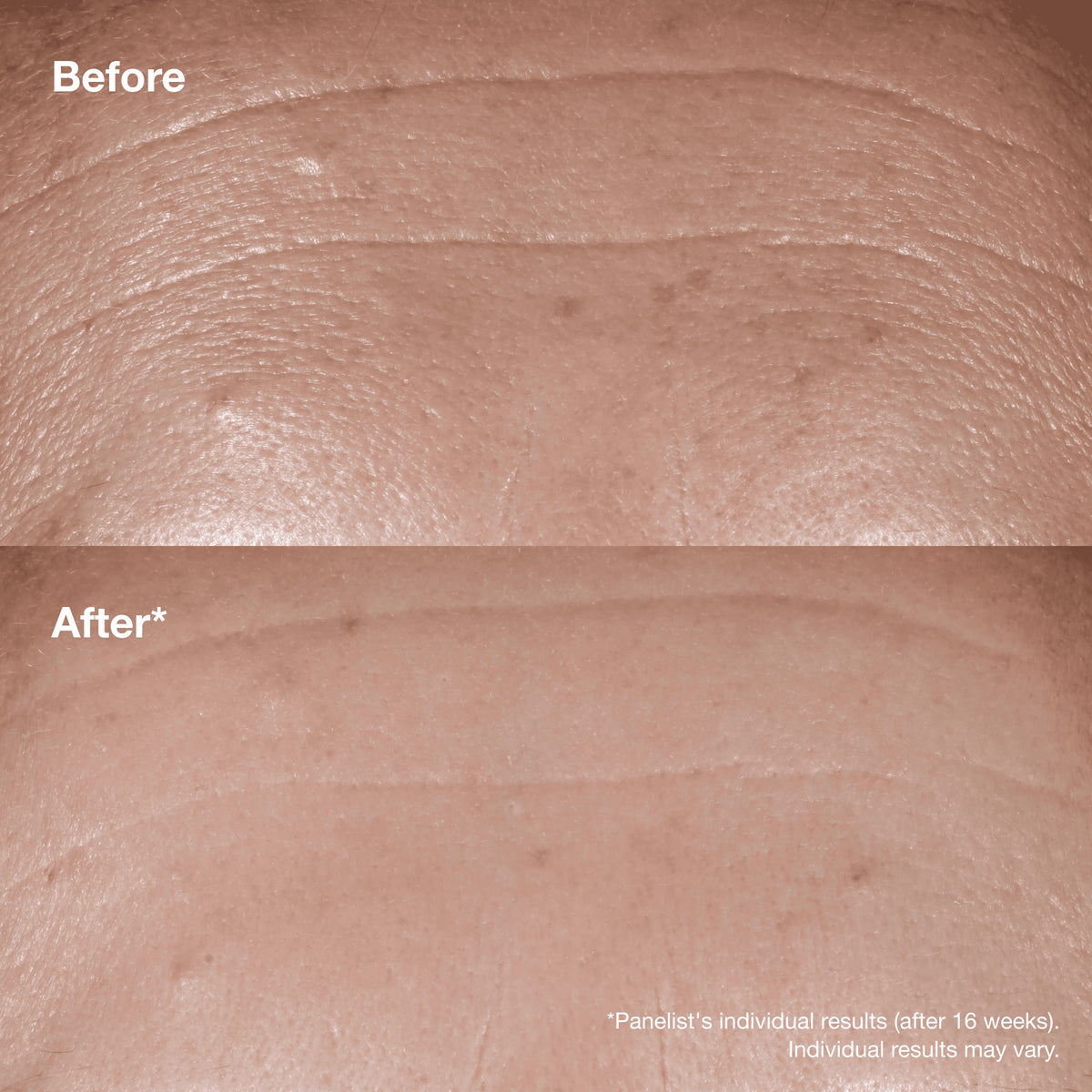 Clinique Smart Clinical Repair™ Wrinkle Correcting Serum