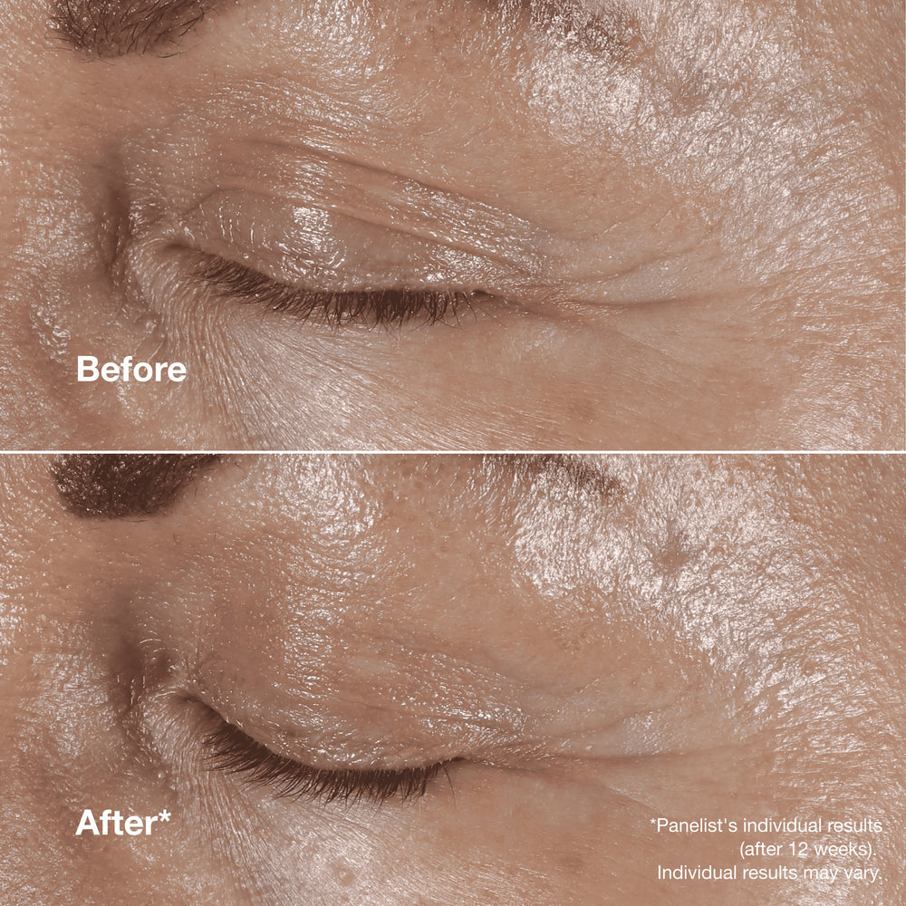 Clinique Smart Clinical Repair™ Wrinkle Correcting Eye Cream