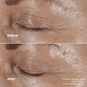 Clinique Smart Clinical Repair™ Wrinkle Correcting Eye Cream