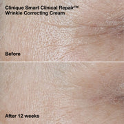 Smart Clinical Repair™ Wrinkle Correcting Cream Gift Set, Model, medium