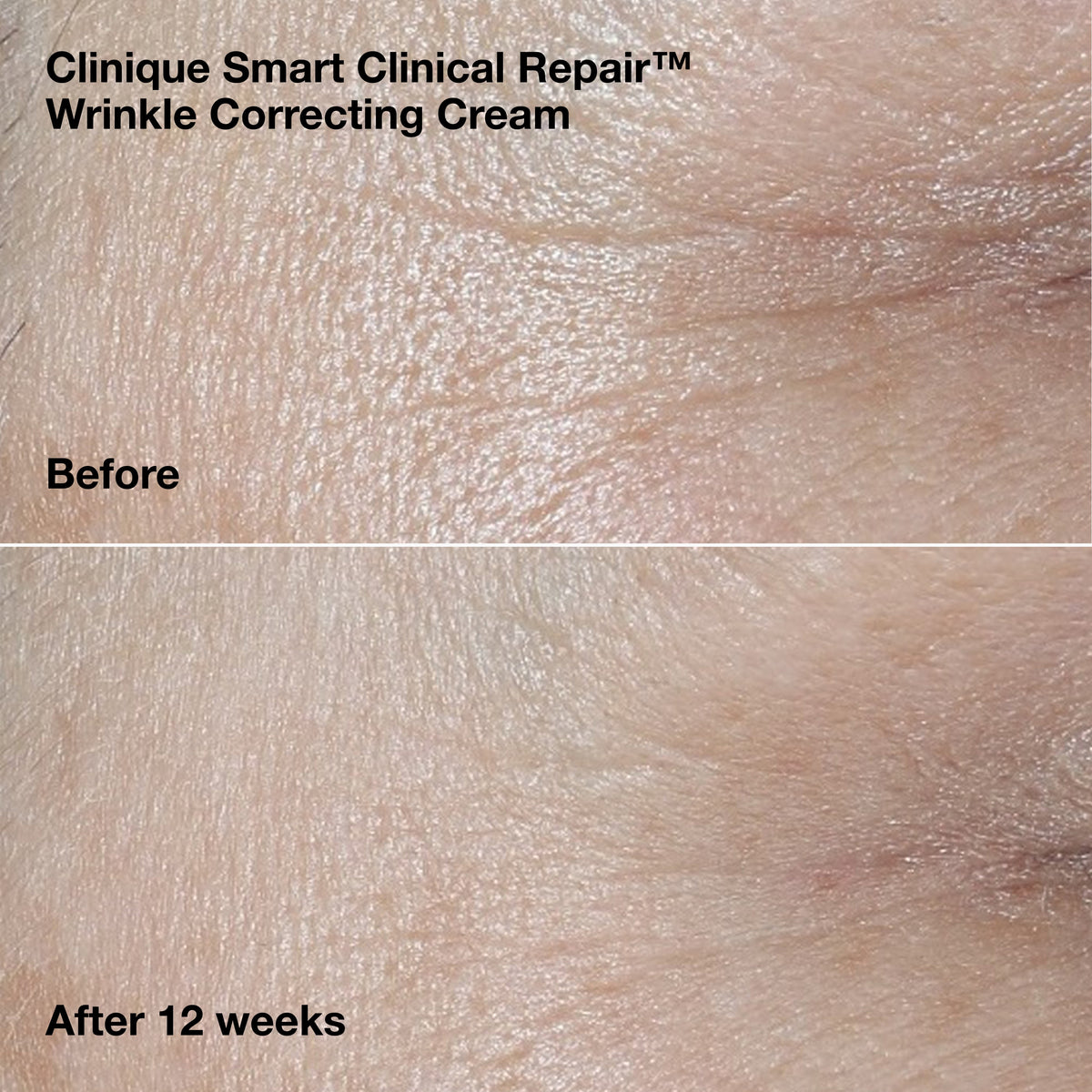 Smart Clinical Repair™ Wrinkle Correcting Cream Gift Set, Model, medium