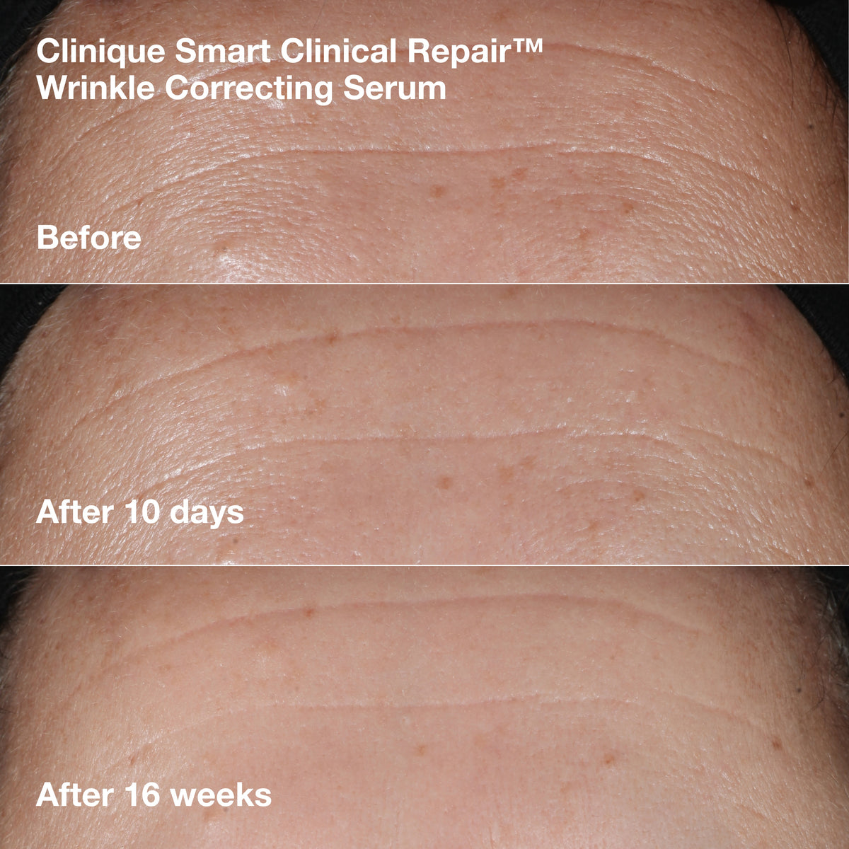 Smart Clinical Repair™ Wrinkle Correcting Cream Gift Set, Model, medium