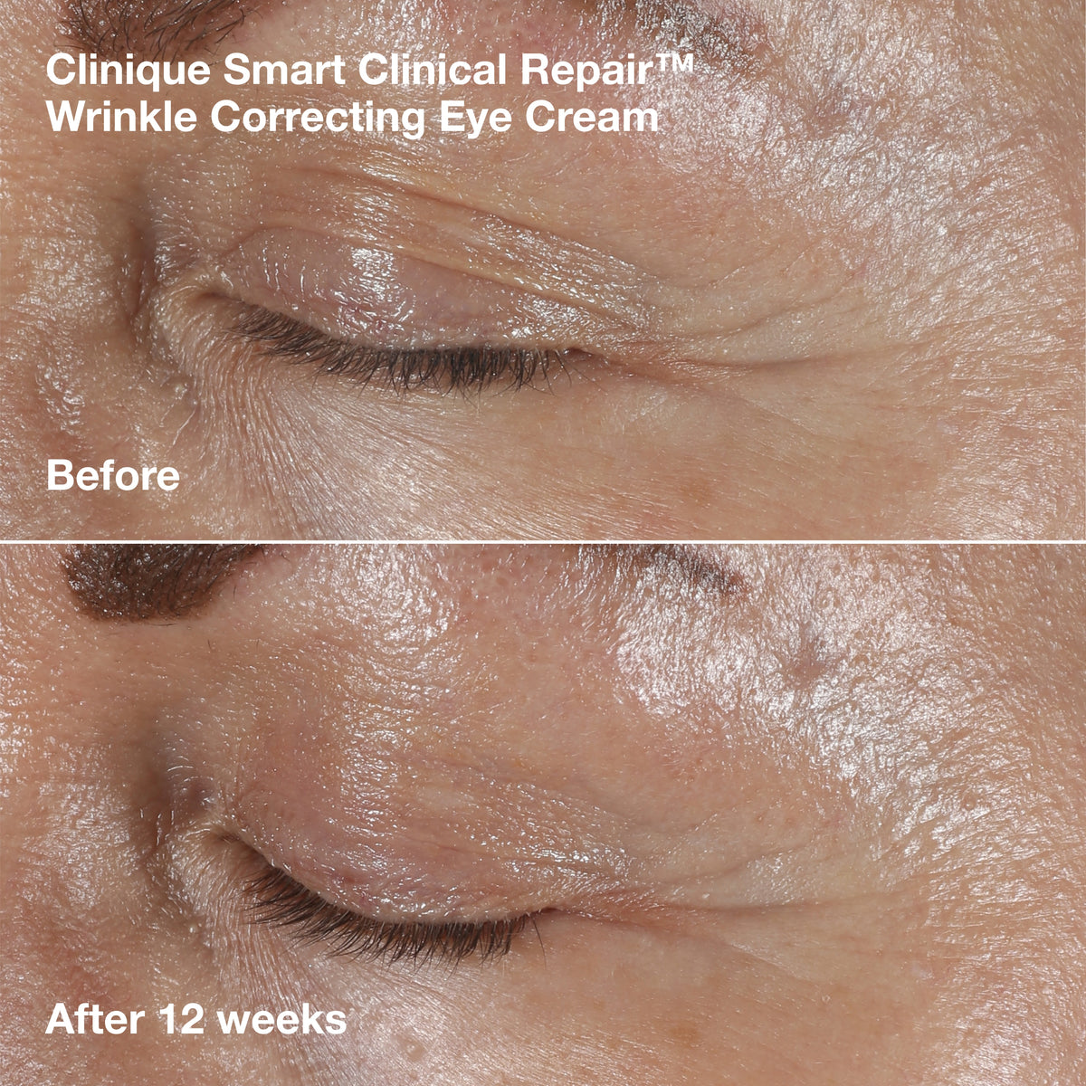 Smart Clinical Repair™ Wrinkle Correcting Serum Gift Set, Model, medium