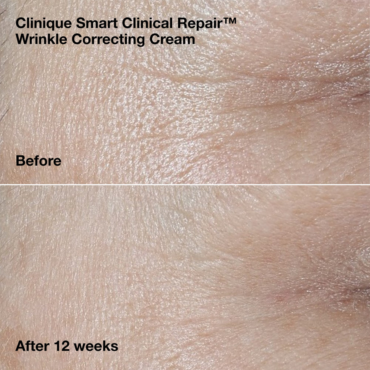 Smart Clinical Repair™ Wrinkle Correcting Serum Gift Set, Model, medium